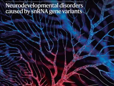 UM contributes to landmark study in ALS